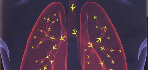 Proof: ultra-fine particles from aircraft affect health